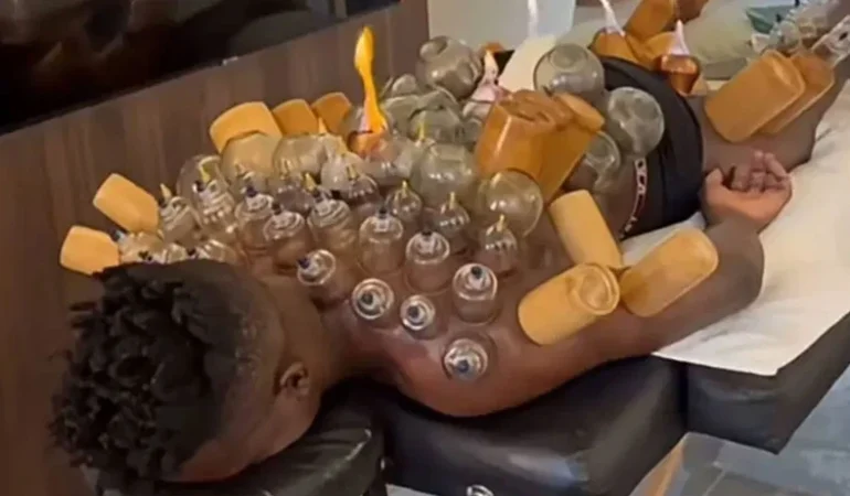 Andre Onana’dan şaşırtan paylaşım! Hacamat yaptırdığı anları yayınladı